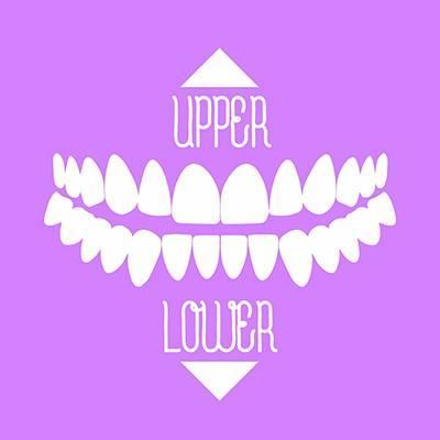 Upper or Lower Jaw Restoration with Dental Implants