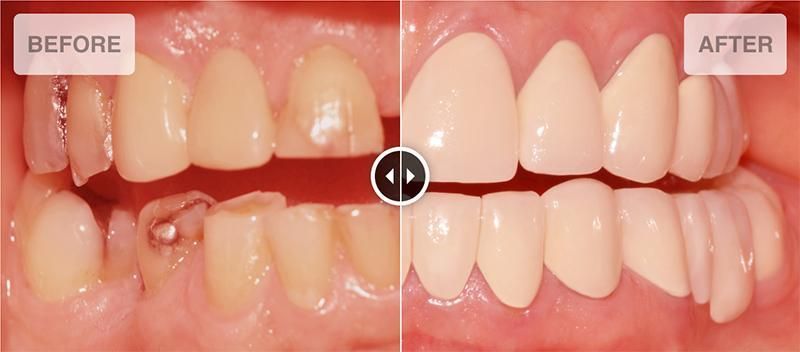 Real cases treated at New Smile Dental Group